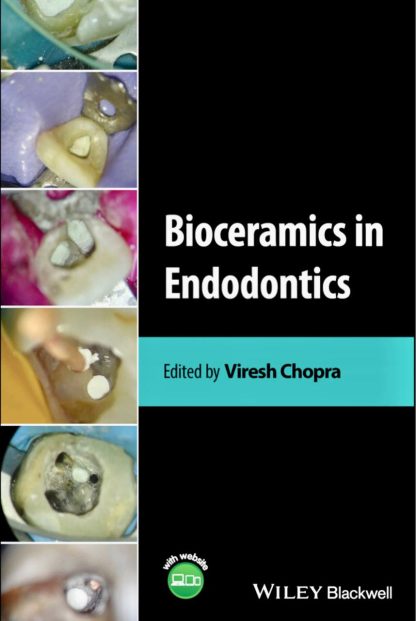 bioceramics in endodontics